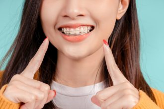Dental Beautiful smiling of young asian woman with retainer