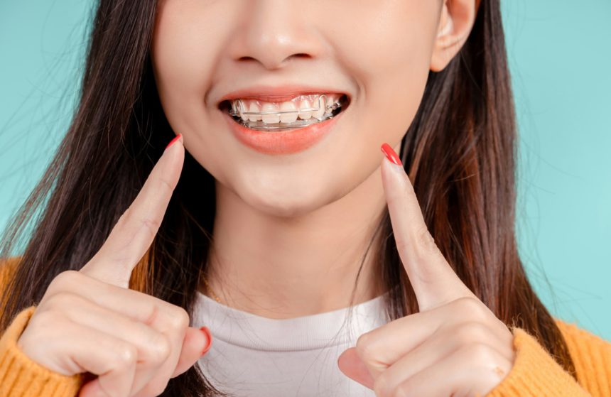 Dental Beautiful smiling of young asian woman with retainer